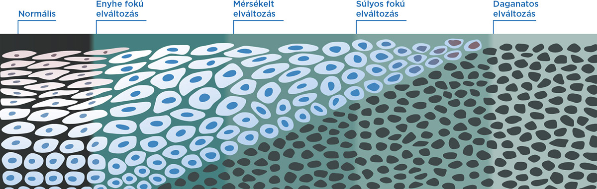 3. illusztráció